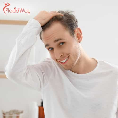 Direct Hair Implantation (DHI) in Turkey: A Complete Guide for Americans Looking for Advanced Hair Restoration